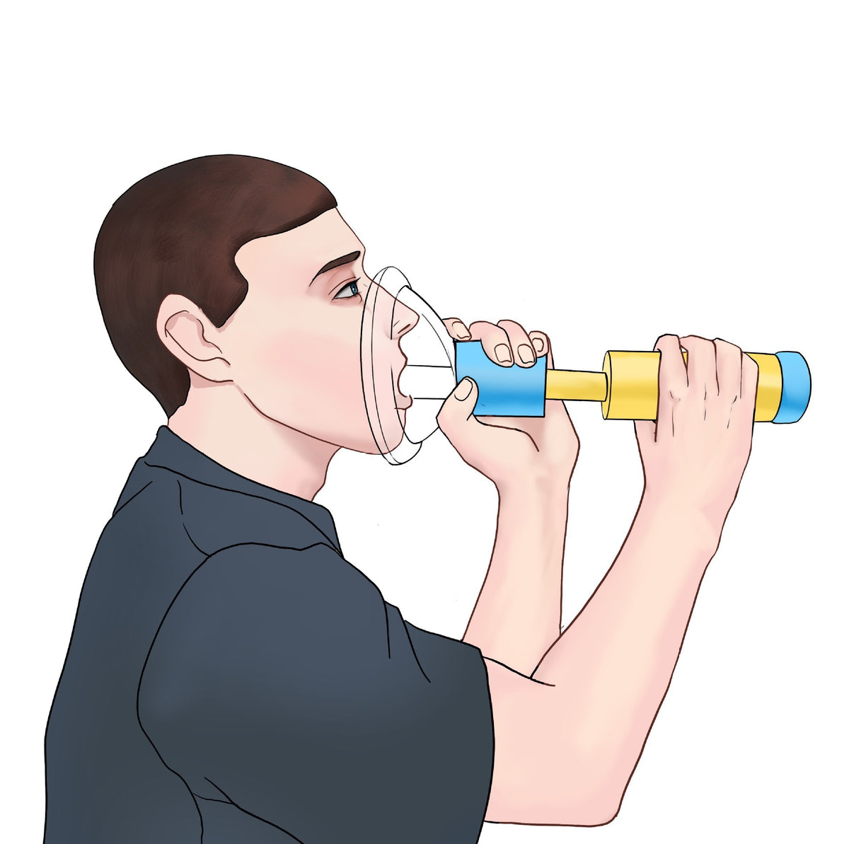 New Upgrade Portable Anti-Choking Device – Life-Saving Suction Vac